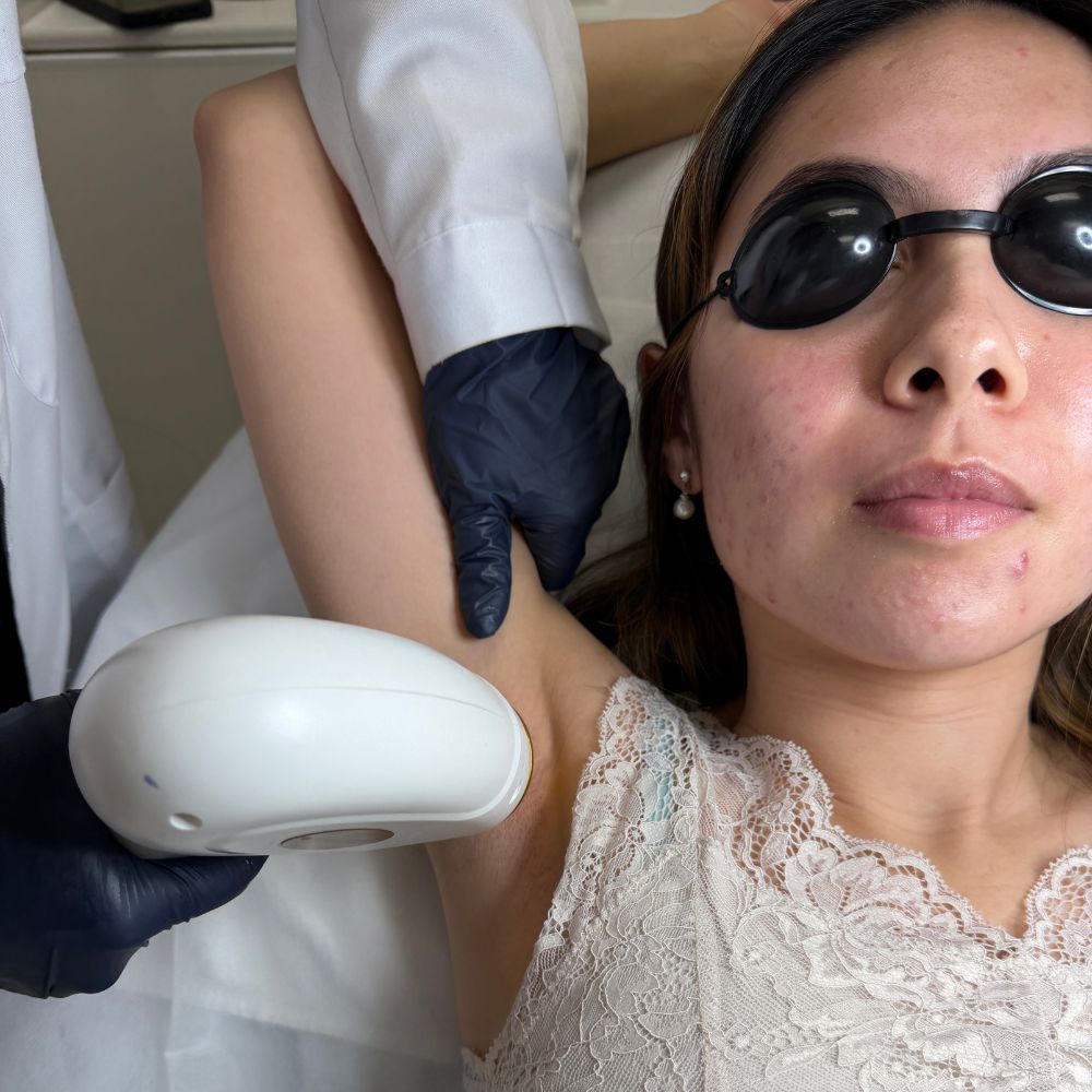 Underarm Laser Hair Removal
