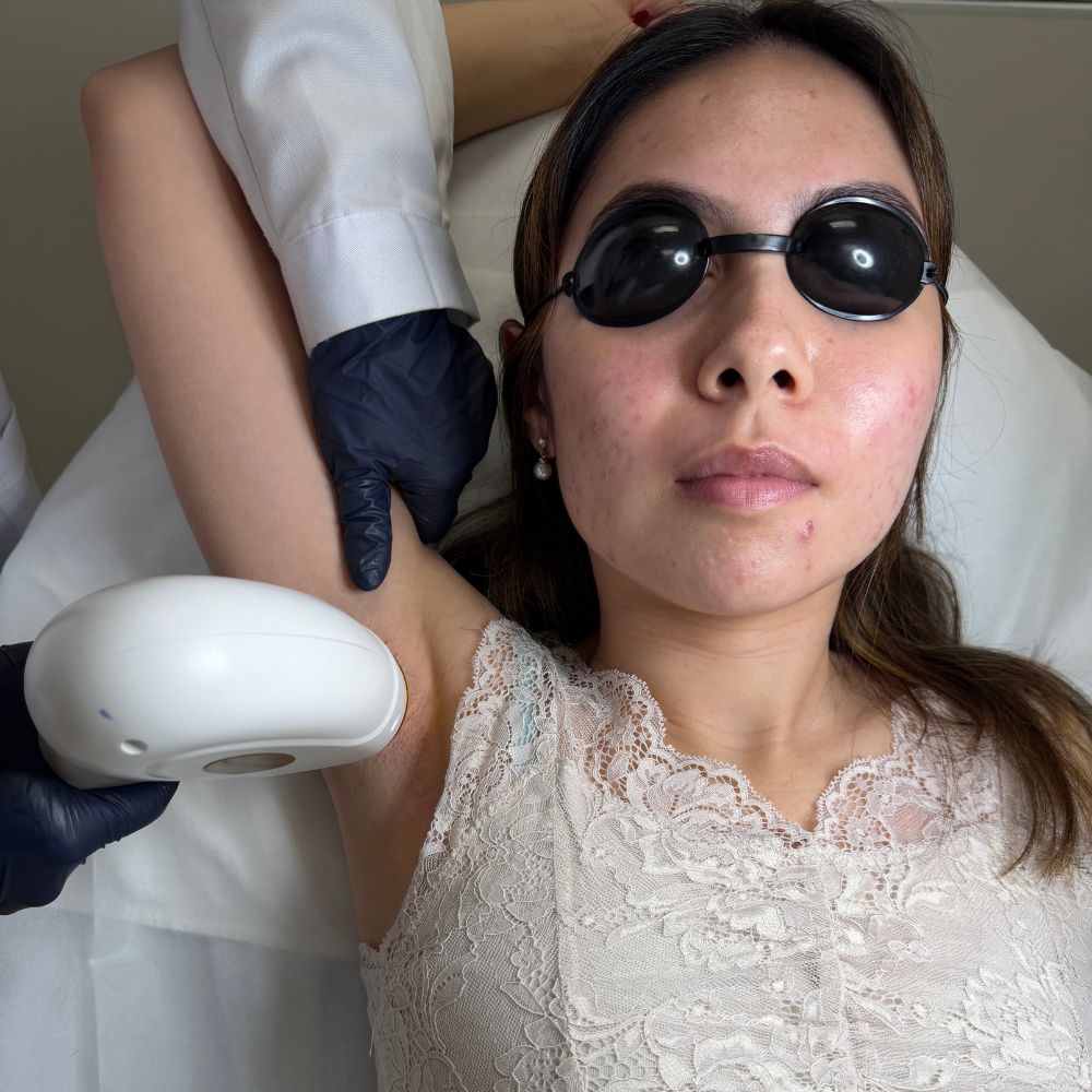 Underarm Laser Hair Removal